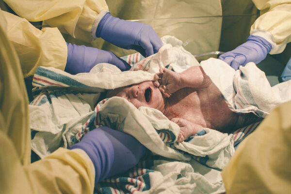 Baby Miracle!